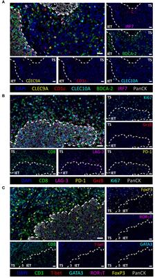 Type I conventional dendritic cells and CD8+ T cells predict favorable clinical outcome of head and neck squamous cell carcinoma patients